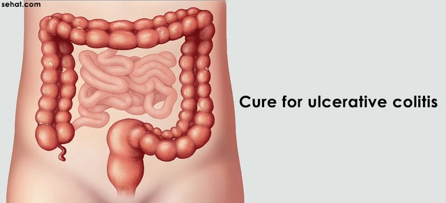 The Connection between Ulcerative Colitis and Irritable Bowel Syndrome (IBS)