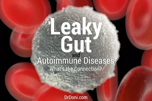 The role of Baricitinib in managing fatigue associated with autoimmune diseases
