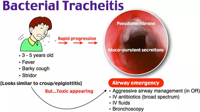 Understanding Bacterial Infections: Causes, Symptoms, and Treatments