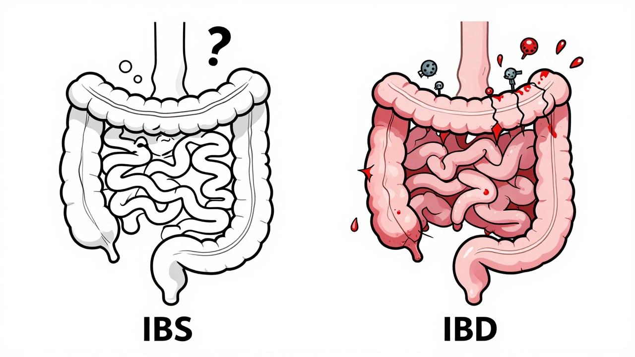 IBS vs. IBD: What’s the Real Difference Between Functional and Inflammatory Bowel Disorders?